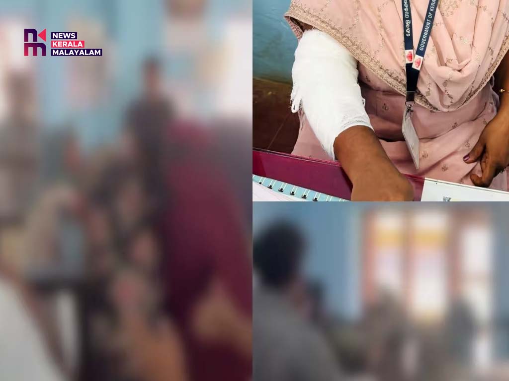 മുക്കത്ത് നഗരസഭ ജീവനക്കാരിയെ കടിച്ച് പരിക്കേൽപ്പിച്ച് ഓഫീസിലെത്തിയ സ്ത്രീ